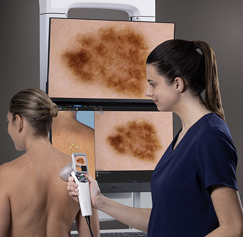 mole scanning