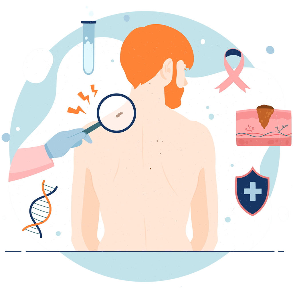 skin cancer explained